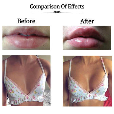 Cross Linked Hyaluronic Acid Filler Crosslinked Gel - Klinisch bewezen natriumhyaluronat