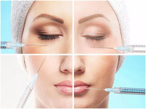 Hyaluronic Zuur Injectiesgel voor Gezichts Statische Rimpels Traangroef 1ml