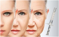 De Zorg van de de Vullerhuid van de gezichtslift PCL Huid Opheffend het Aanhalen Bevorderend Collageen