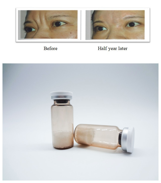 PLLA Poly-L-Lactic Acid Dermal Filler injecteerbaar Verwijder gezichtsrimpels Stimuleren collageen regeneratie