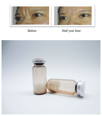 Biocompatibele injecteerbare PLLA Filler Dermale filler voor langdurige volumeherstel van het gezicht en rimpelcorrectie